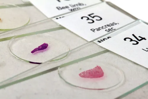 fényképe Levenhuk N80 NG „Láss mindent!” tárgylemezkészlet,  5